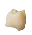 Navadha Tooth-colored resin for 3D printing of temporary restorations