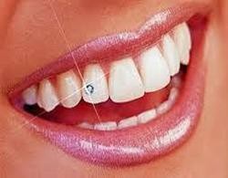 Dental Jewellery - White
