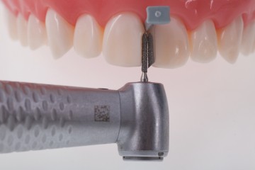 Directa FenderWedge Prep Dental Wedge