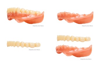 CROWNTEC Resin for Dental 3D printing - 500 gm