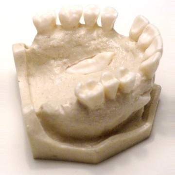 Dental Typodont Jaw / Model for Surgery Practice