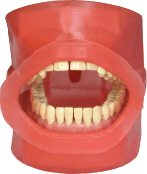 Oral Cavity Cover for Navadha ZX Jaw