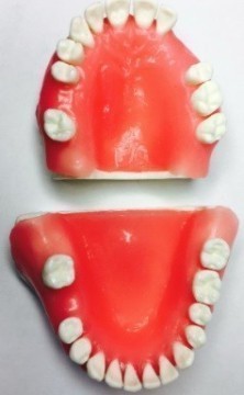 Extraction Dental Jaw Model
