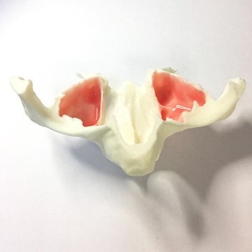 Zygomatic implant sinus dental model
