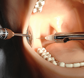 Oral Anaesthesia Training Manikin