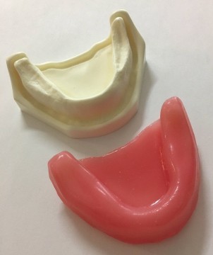 Implant mandible with gums