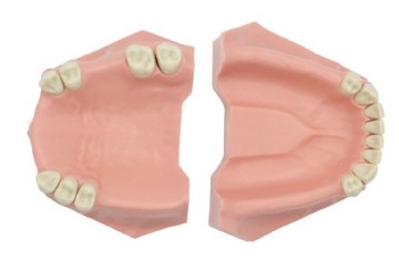Partial Model for Prosthesis
