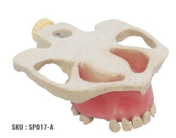 Radiopaque Model for Sinus Lift and Implant Placement