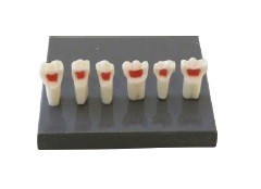 Paediatric Mixed Dentition Typodont Practice Jaw set