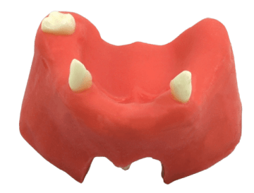 Mandible & Maxilla with Soft Gums for Implant Training