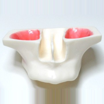 Sinus Lift model - White Resin