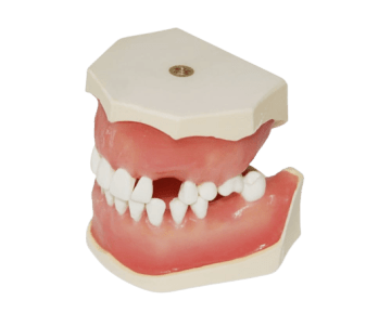 Dental Typodont Jaw / Model for Surgery Practice