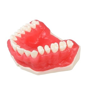 Upper model of periodontology