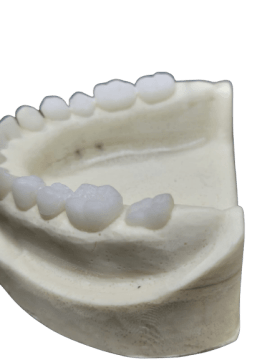 Radio-opaque X-Ray Dental Model