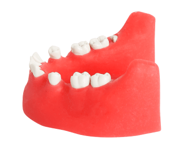 Impacted tooth Extraction Surgery Dental Jaw Model