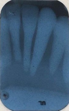 Radiology X-ray training dental phantom head manikin