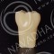 Frasaco AG-3 ZE Typodont Replacement Teeth